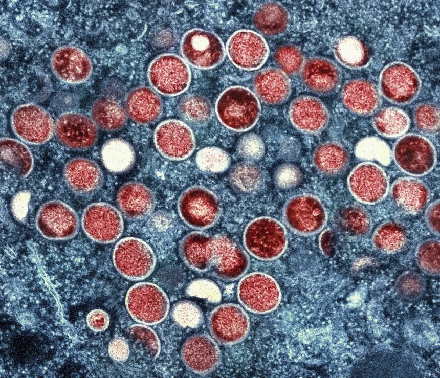 Mpox  — Foto: National Institute of Allergy and Infectious Diseases/AP